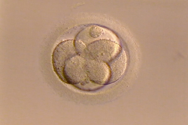 为什么试管都要先移植鲜胚-原因有三点（内附移