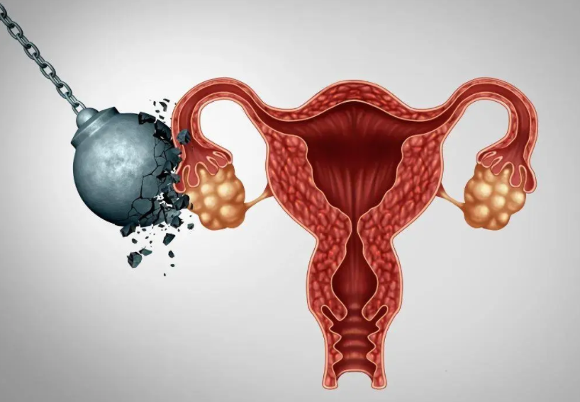 大连53岁助孕中介：输卵管堵塞导致怀孕失败! 我做了一次成功的试管婴儿（案例研究）。